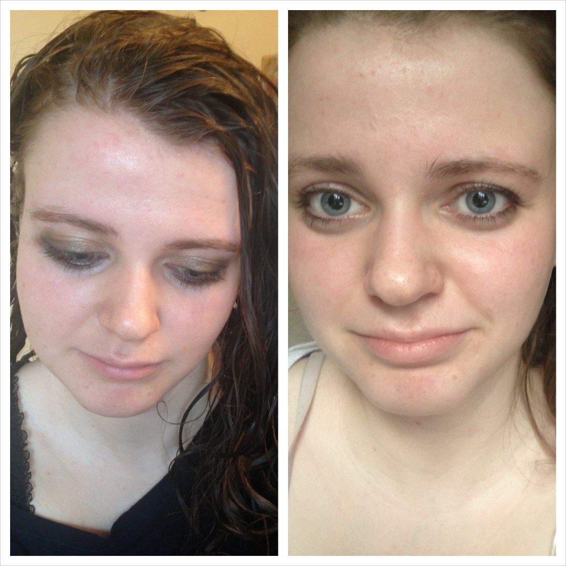 left: without face makeup when I started using right: makeupless after five months of use